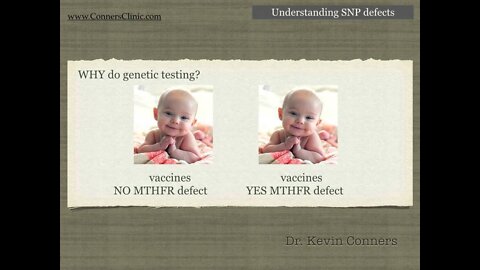 SNP Defects Basics | Dr. Kevin Conners - Conners Clinic