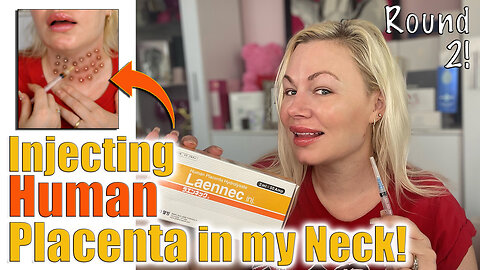 Injecting Human Placenta in my Neck, Round 2 from AceCosm.com | Code Jessica10 Saves you Money $$$