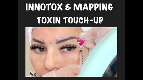 Innotox Touch-up and Mapping