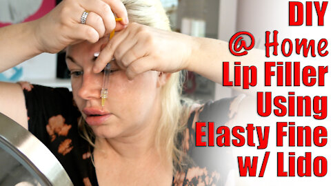 Elasty Fine with Lido Lip Filler Touch Up from www.acecosm.com | Code Jessica10 Saves you Money!