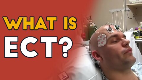 What is Electroconvulsive Therapy (ECT)?