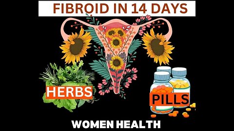 Fibroid Surgey - Not YET!