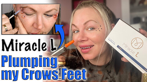 Plumping Crows Feet with Miracle L AceCosm | Code Jessica10 Saves you Money