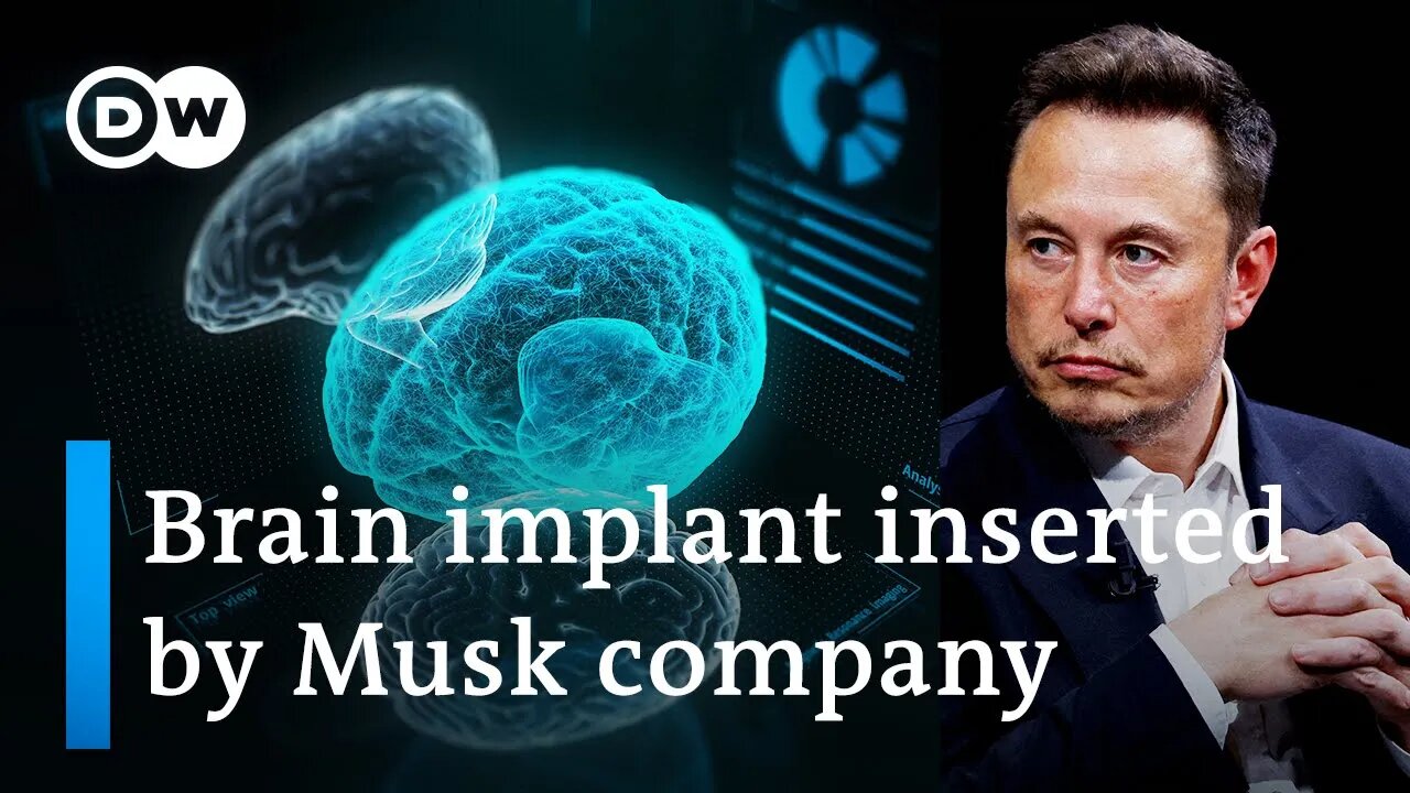 Elon Musks Neuralink Implants First Chip In Human Brain Dw News 