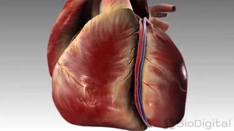 3D medical animation: What is a heart attack?