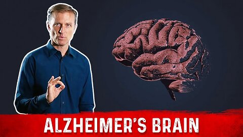 What is Alzheimer's Disease? – The Alzheimer's Brain – Dr.Berg