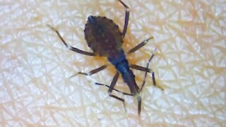 How to Survive a Kissing Bug Infestation