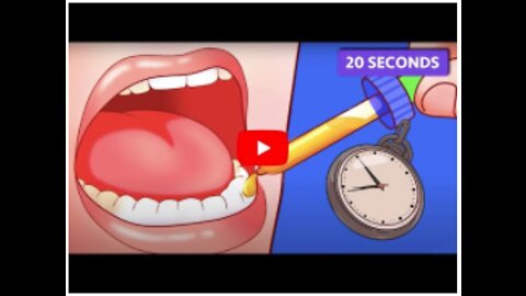 Simple, easy routine Solved My horrible teeth and gum problems