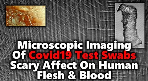Covid Test Swabs Contain DARPA HYDROGEL & Lithium