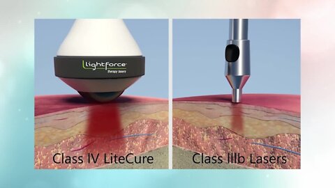 Tired of living in pain? Laser Pain Away™ announces LightForce® XLi 40 watt Deep Tissue Therapy Laser