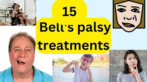 15 Bell's palsy treatments