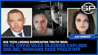 Big Tech Losing Bioweapon Truth War: Real Covid Vaxx Injuries EXPLODE online