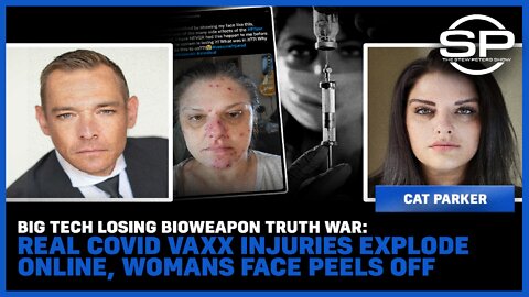 Big Tech Losing Bioweapon Truth War: Real Covid Vaxx Injuries EXPLODE online