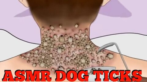 ASMR REMOVAL DOG TICKS FROM THE BACK OF THE MAN'S//RELAXING ASMR ANIMATIONS 2023JULY05