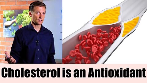 Antioxidant: Another Interesting Cholesterol Function Explained by Dr. Berg