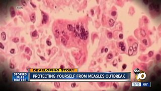 Doctor: Measles will reach San Diego