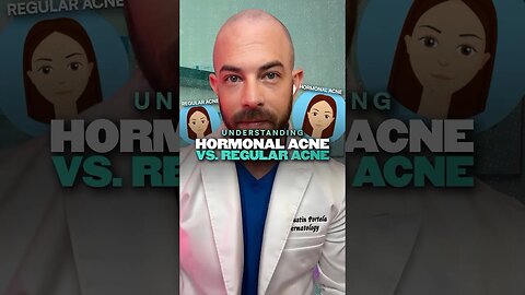 What’s the difference between regular and hormonal acne? Derm explains! #hormonalacne