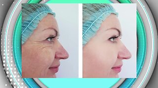 Hollywood Body Laser-Removing Fat and Non Surgical Facelifts