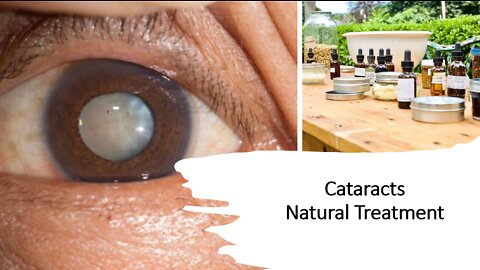Cataracts Natural Treatment