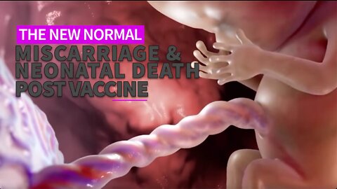 THE NEW NORMAL: MISCARRIAGE AND NEONATAL DEATHS POST VACCINE