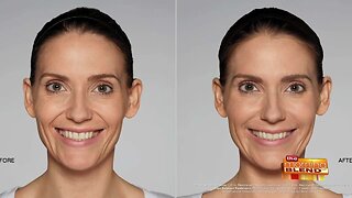 Increasing Your Confidence in Your Smile
