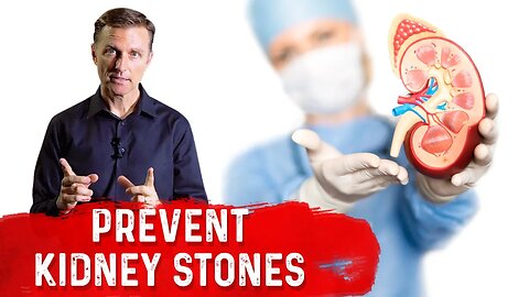 Use Vitamin A for Kidney Stones – Vitamin A Deficiency & Kidney Stones – Dr.Berg