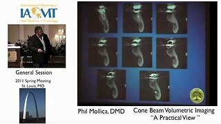 Dr. Phil Mollica discusses cone beam volumetric imaging in dentistry IAOMT St. Louis 2011