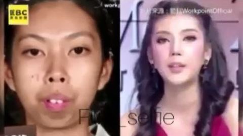 How Plastic Surgery Changed This Girl's Life