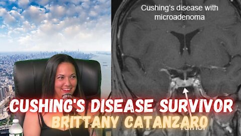 Surviving Cushing's Disease