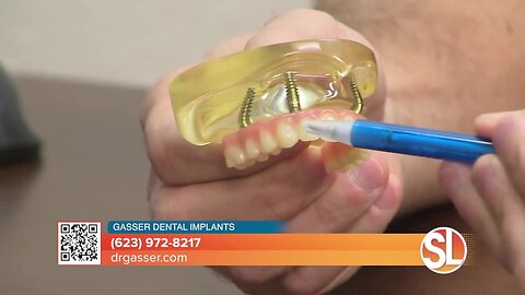 Learn about the benefits of dental implants with Dr. Kevin Gasser of Gasser Dental Implants