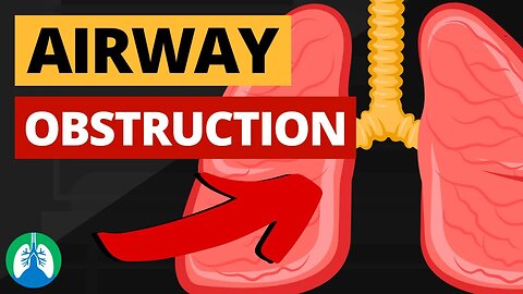 Airway Obstruction (Medical Definition) | Quick Explainer Video