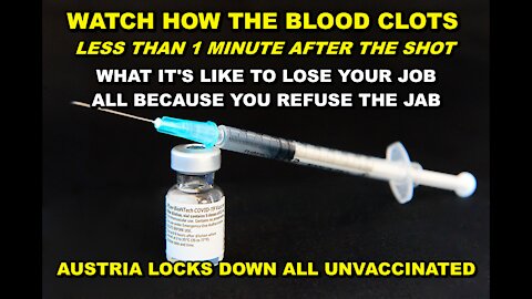 HOW THE PFIZER VACCINE CLOTS YOUR BLOOD IN UNDER A MINUTE - AUSTRIA LOCKS DOWN ALL THE UNVACCINATED