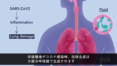 ワクチンは殺人兵器である確たる証拠