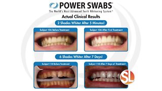 Want to look younger, healthier? Try Power Swabs Teeth Whitening