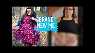 I've Never Revealed My Excess Skin - Until Now | BRAND NEW ME