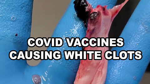 Covid Vaccines Causing White Clots - United States
