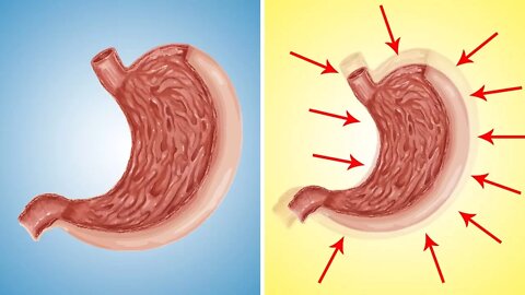 You Can Actually 'Shrink' Your Stomach Through Diet, Study Says