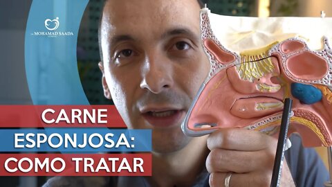 Carne Esponjosa: O Que é, Sintomas e Como Tratar