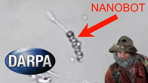 WATCH A DARPA NANBOT INSERT A RETARDED SPERM IN TO AN EGG! LINKS! 👀