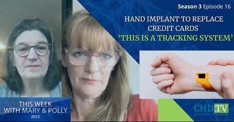 This Is A Tracking System' – Hand Implant Allows People To Pay With Chip + More