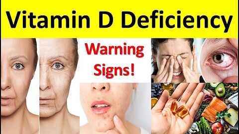 Symptoms of Vitamin D deficiency- and food treatments- you must know