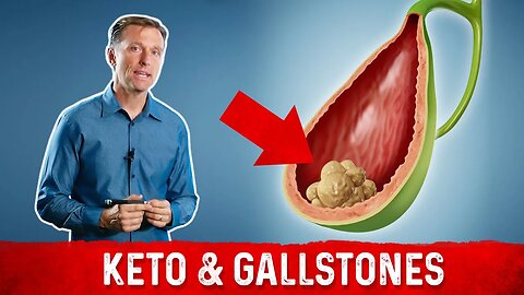 Doesn't Keto Cause Gallstones Eating All That Fat?