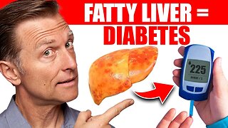 Your Fatty Liver Caused Your Diabetes