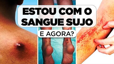 ESTOU COM O SANGUE SUJO E AGORA? | DR. ANDRÉIA MOMBACH - FERNANDO BETETI