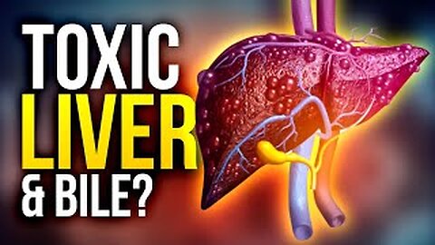 Are Toxic Bile & Cholestasis the key to Liver Health & Detoxification? Rejuvenate Pod Episode 16