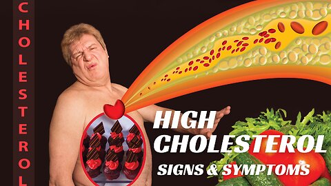 9 SIGNS & SYMPTOMS OF HIGH CHOLESTEROL YOU MUST NOT IGNORE