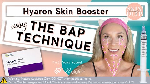 Get Glowing Skin with Hyaron Skin Booster Using the BAP Technique!