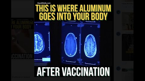 THIS IS WHERE ALUMINUM GOES INTO YOUR BODY AFTER VACCINATION