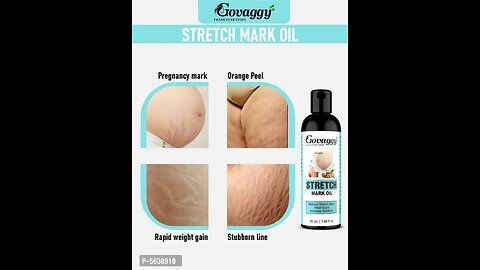 Body stretch marks problem solving product