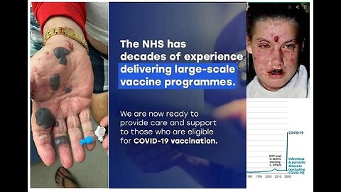 FOOD FOR THOUGHT - ARE THE COVID VACCINES INDEED 'SAFE AND EFFECTIVE"?! Apr 2021